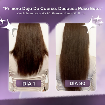Vitaminas Capilares Densia 24 en 1 — Crecimiento y Prevención de Caída